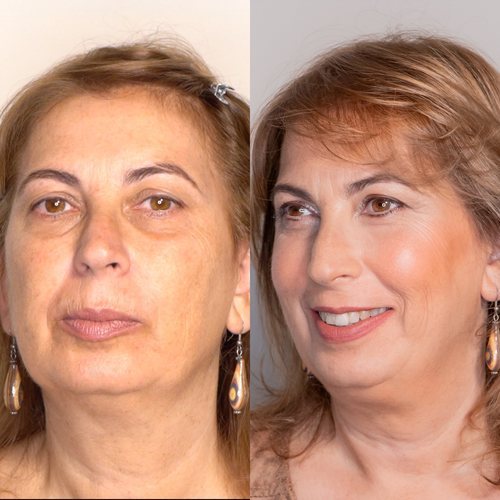 Corso Trucco anti Age